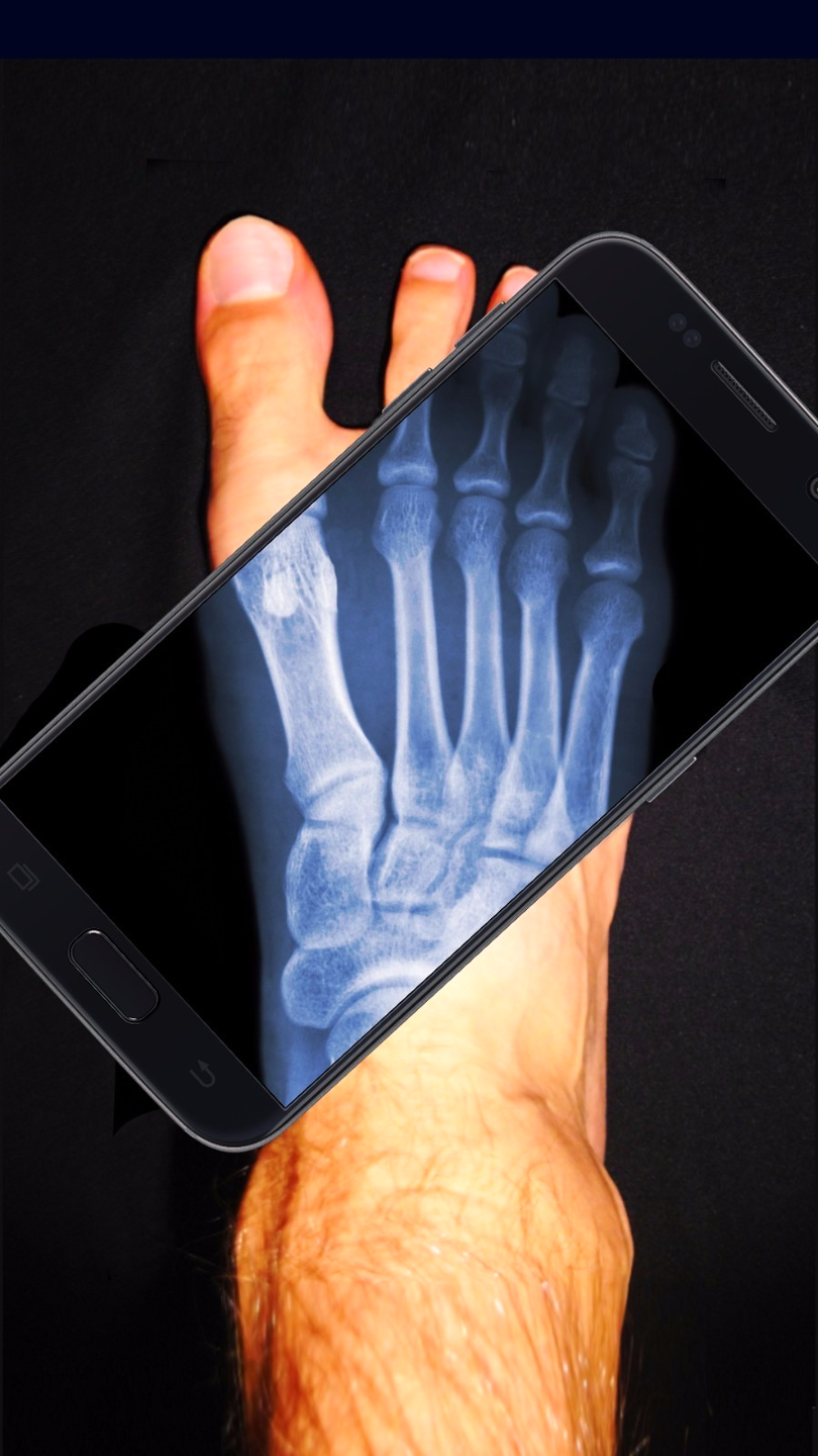 x射线身体扫描模拟器游戏截图1
